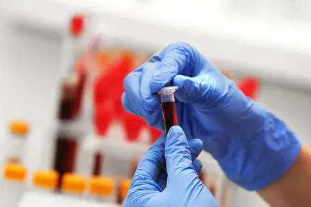 BABIO запускає флуоресцентний швидкий тест на вагітність великої рогатої худоби